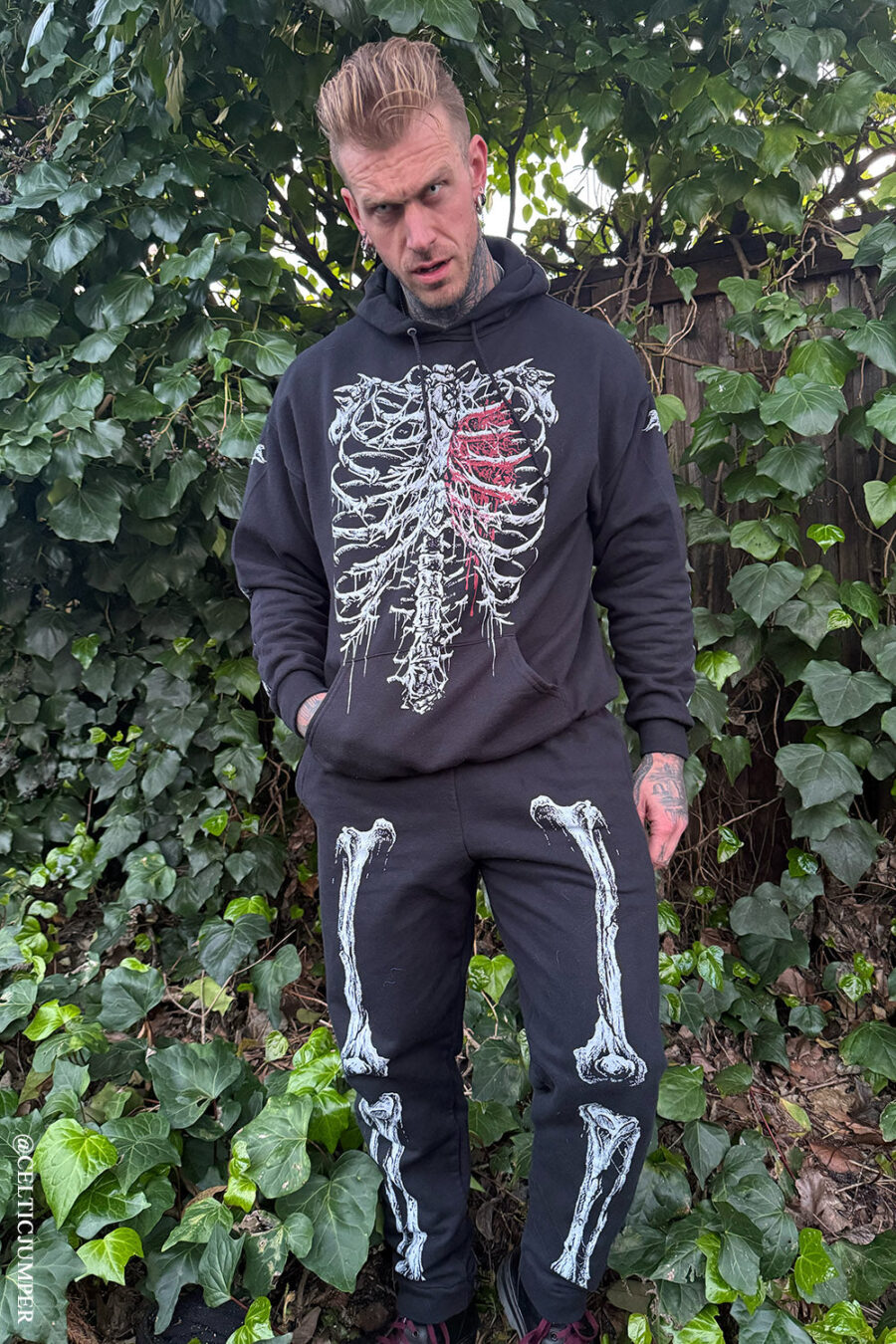 Dead Inside Skeleton Joggers